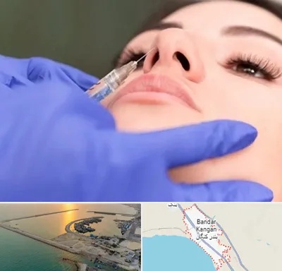 هیالاز در بندر کنگان