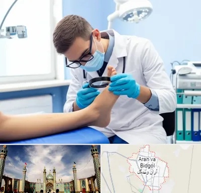 درمان زخم پای دیابتی در آران و بیدگل