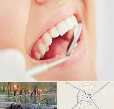 اصلاح طرح لبخند در بروجن