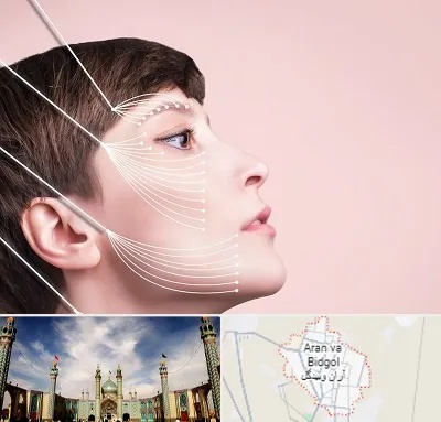 اندولیفت پیشانی در آران و بیدگل