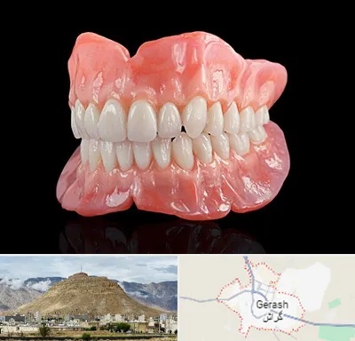 ساخت دندان مصنوعی در گراش