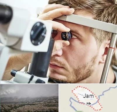 فوق تخصص قرنیه در جم