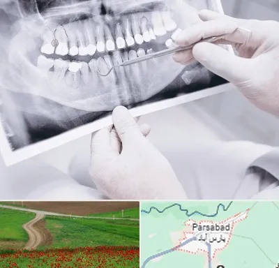 رادیولوژی دهان و دندان در پارس آباد