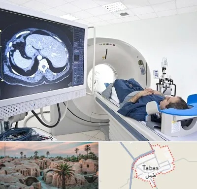 مرکز تصویر برداری پزشکی در طبس