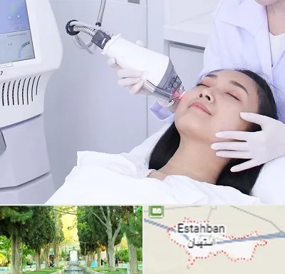وایتنینگ در استهبان