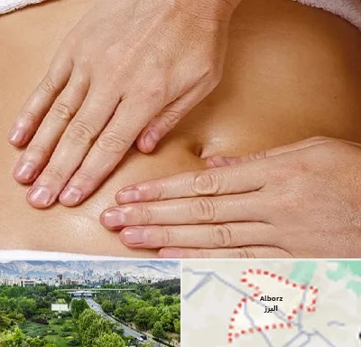 متخصص ناف گیری در البرز