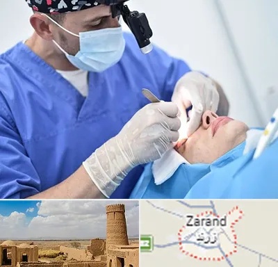 جراح سرطان چشم در زرند