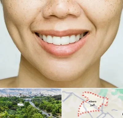 عمل چال گونه در البرز