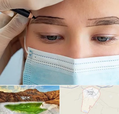 کاشت ابرو در گرمسار