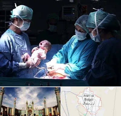 جراح سزارین در آران و بیدگل