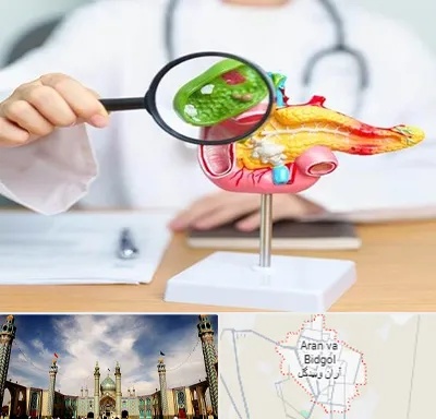 جراح سرطان پانکراس در آران و بیدگل
