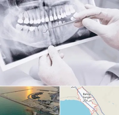 رادیولوژی دهان و دندان در بندر کنگان