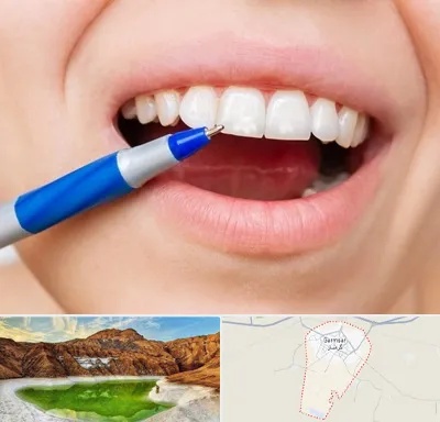 دندانسازی ارزان در گرمسار