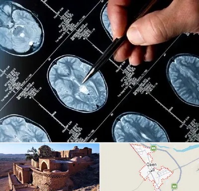 دکتر تشنج در قائن