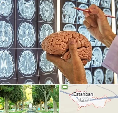 جراح مغز و اعصاب در استهبان