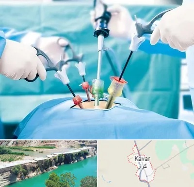 جراح فیبروم در کوار