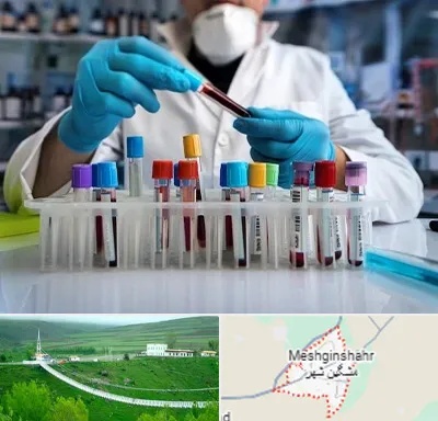 آزمایشگاه خون در مشگین شهر