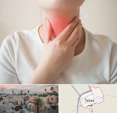 دکتر سرطان مری در طبس