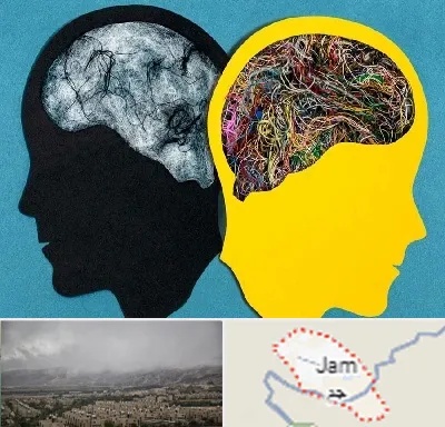 دکتر اختلال دوقطبی در جم
