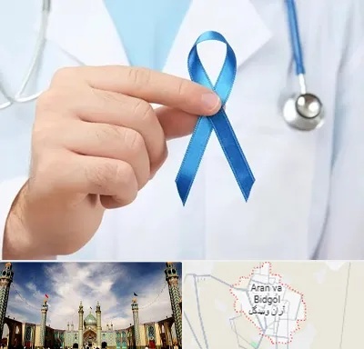 دکتر سرطان بیضه در آران و بیدگل