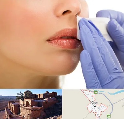 اپیلاسیون صورت در قائن