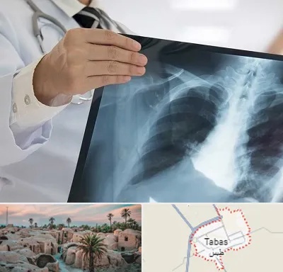 فوق تخصص ریه در طبس