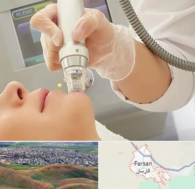 آر اف فرکشنال در فارسان
