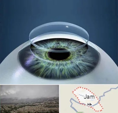 پیوند قرنیه در جم