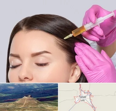 تزریق هیر فیلر در تکاب