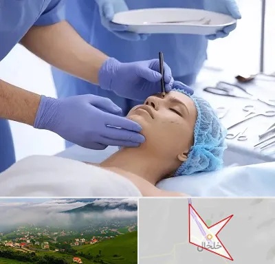 عمل بینی طبیعی در خلخال