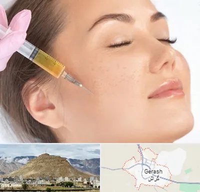آموزش تزریق ژل و بوتاکس در گراش