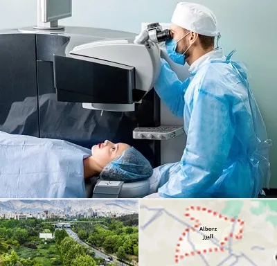 مرکز لیزیک چشم در البرز