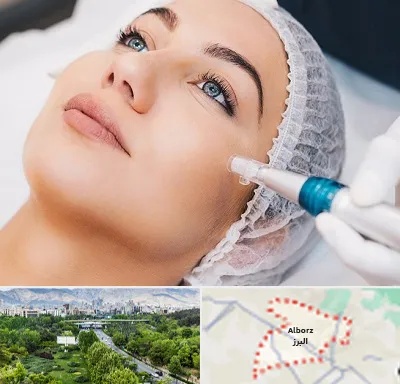 مزونیدلینگ در البرز