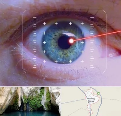 فمتولیزیک در خورموج