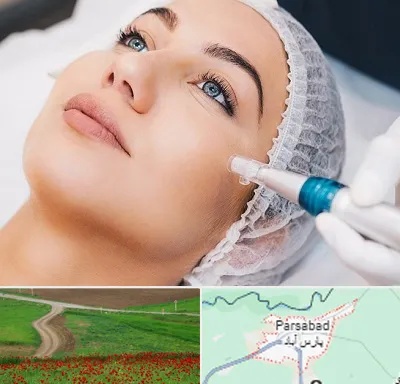مزونیدلینگ در پارس آباد