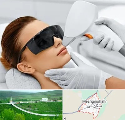 مرکز لیزر مو در مشگین شهر