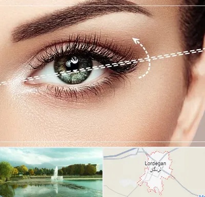 جراحی چشم گربه ای در لردگان