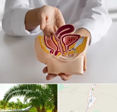 دکتر دستگاه تناسلی مردان در کهنوج