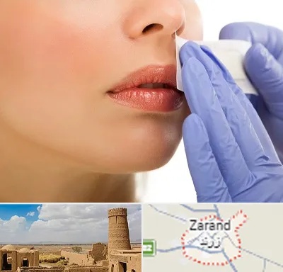 اپیلاسیون صورت در زرند