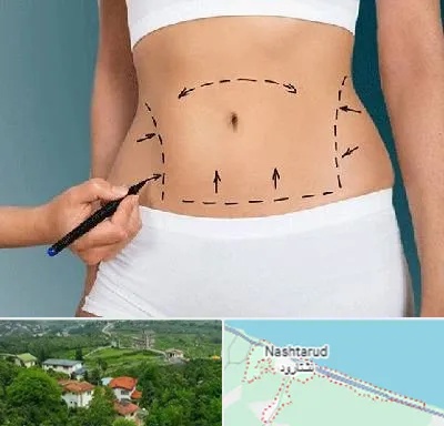 دکتر طب سنتی برای لاغری در نشتارود