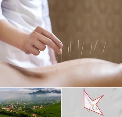 درای نیدلینگ در خلخال