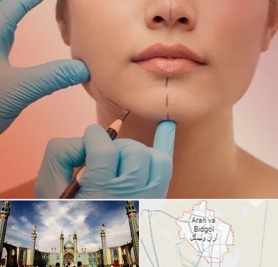 دکتر زیبایی خانم در آران و بیدگل