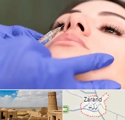 هیالاز در زرند