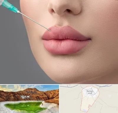 کلینیک ژل لب روسی در گرمسار