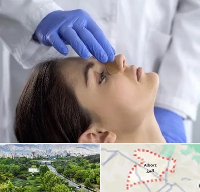 عمل بینی عروسکی در البرز