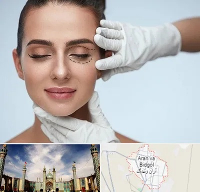 عمل پف چشم در آران و بیدگل