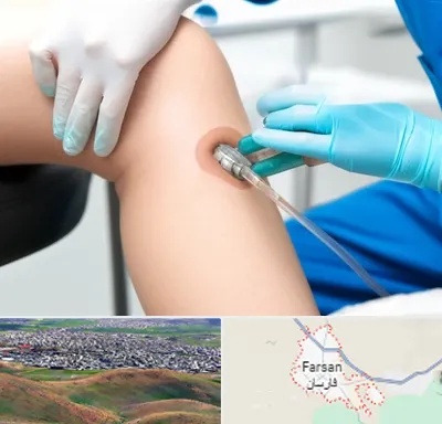 اوزون تراپی در فارسان