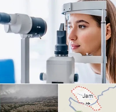 فوق تخصص شبکیه در جم