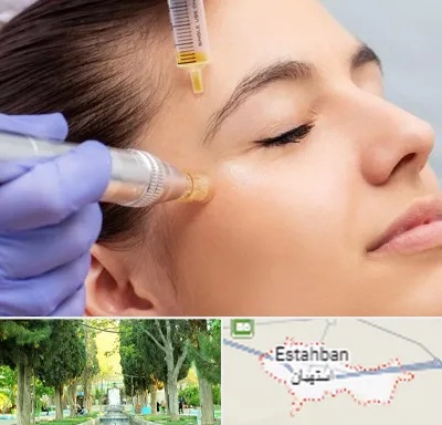 میکرونیدلینگ در استهبان
