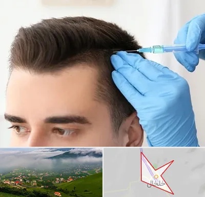 مزوتراپی مو در خلخال
